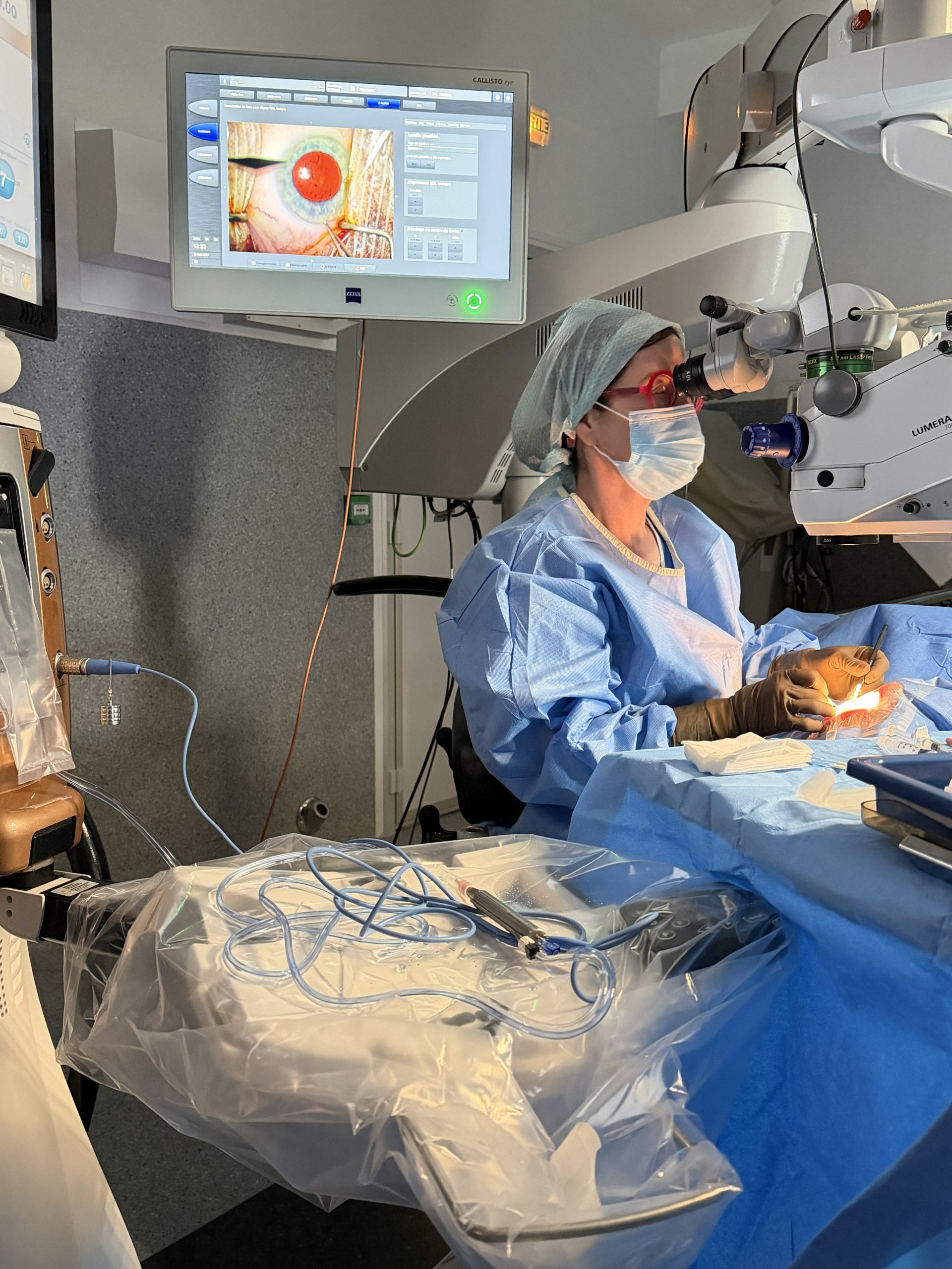 Dr Alina Stalker opérant une cataracte au microscope chirurgical, avec l’image microscopique affichée sur l’écran du bloc opératoire